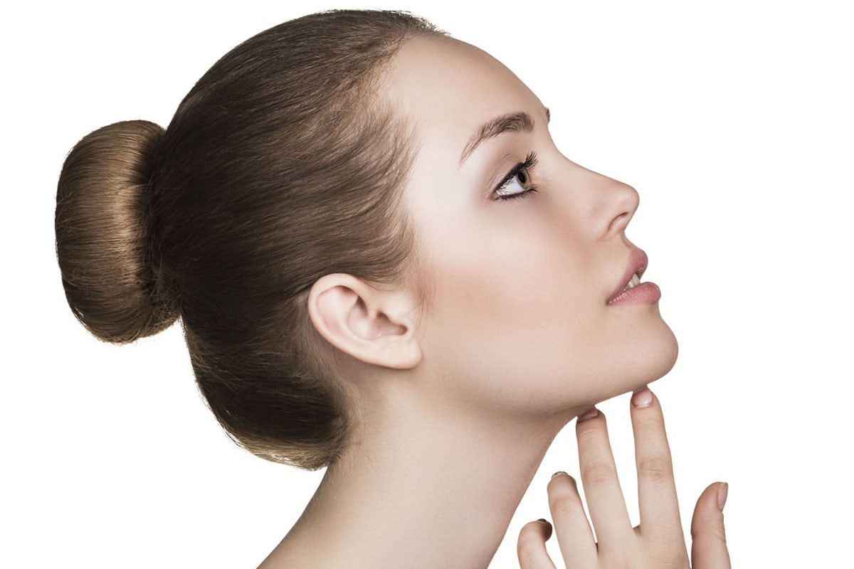 chin implant
