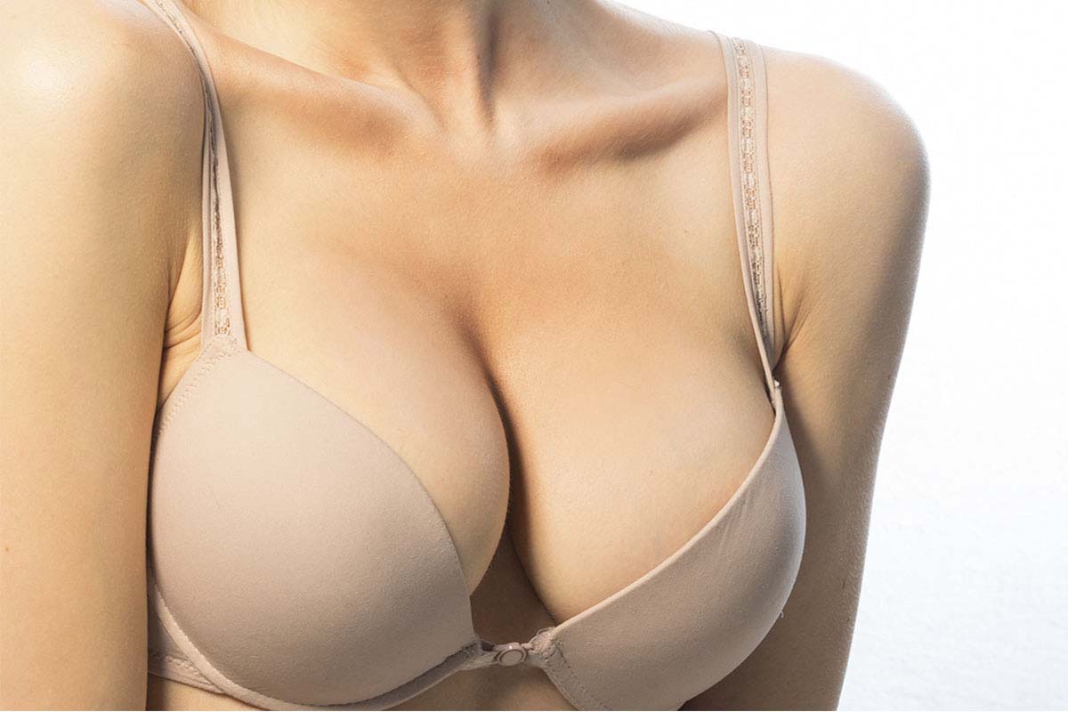 breast augmentation